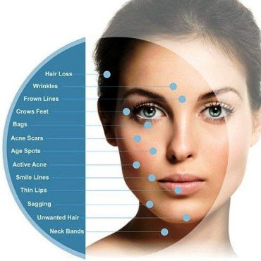 microneedling-anwendung-k-q.jpg