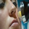 Microneedling2-700x420x72dpi